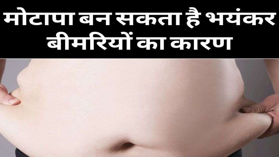 Health News : मोटापा बन सकता है भयंकर बीमरियों का कारण, कम करने के लिए करें इन चीजों का सेवन 